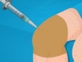 Joc Operate Now: Knee Surgery