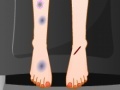 Joc Sara Feet Accident