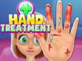 Joc Hand Treatment