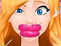 Joc Cute Lips Plastic Surgery