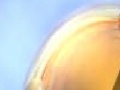 Joc Gem Globoid: Resistance Battle